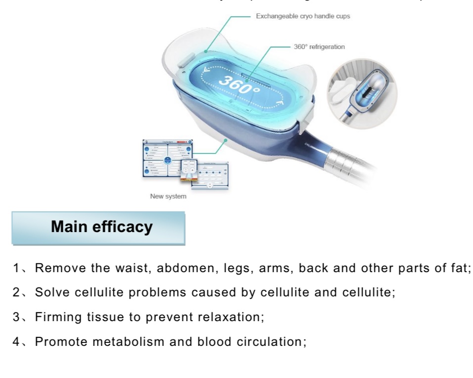 Cryolipolysis gallery image 3