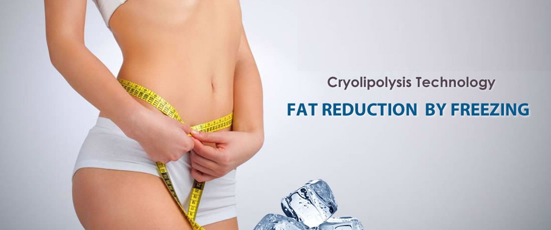 Cryolipolysis gallery image 1